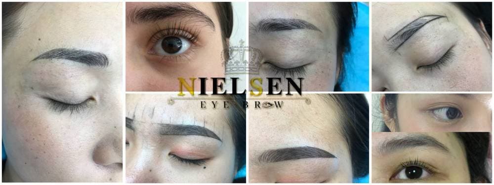 Nielsen Eyebrow คิ้วสวย เชียงราย - อุบลราชธานี | clinic