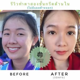 Number 1 ranking(Plastic Surgery) in Northern Thailand
